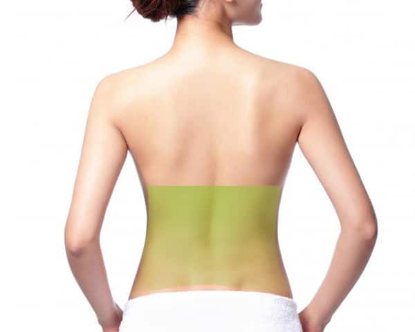 Lower Back Laser Hair Removal for Women