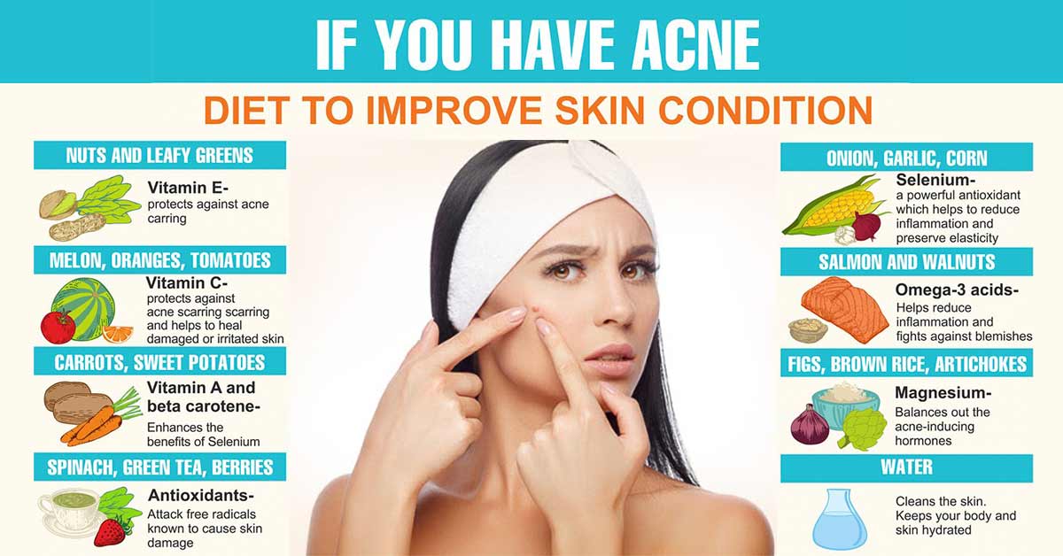 6 Foods for Clear Skin – Can Eating Certain Foods Get Rid of Acne?