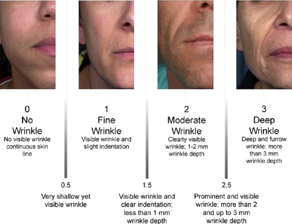 There are differences between fine lines and wrinkles., by Smith