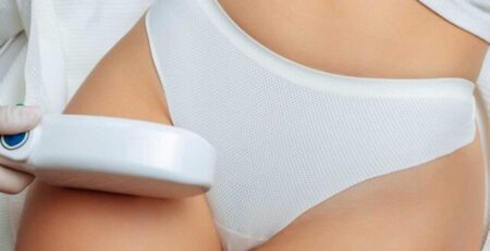 Brazilian laser hair removal